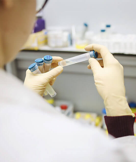 Zľava na test na koronavirus