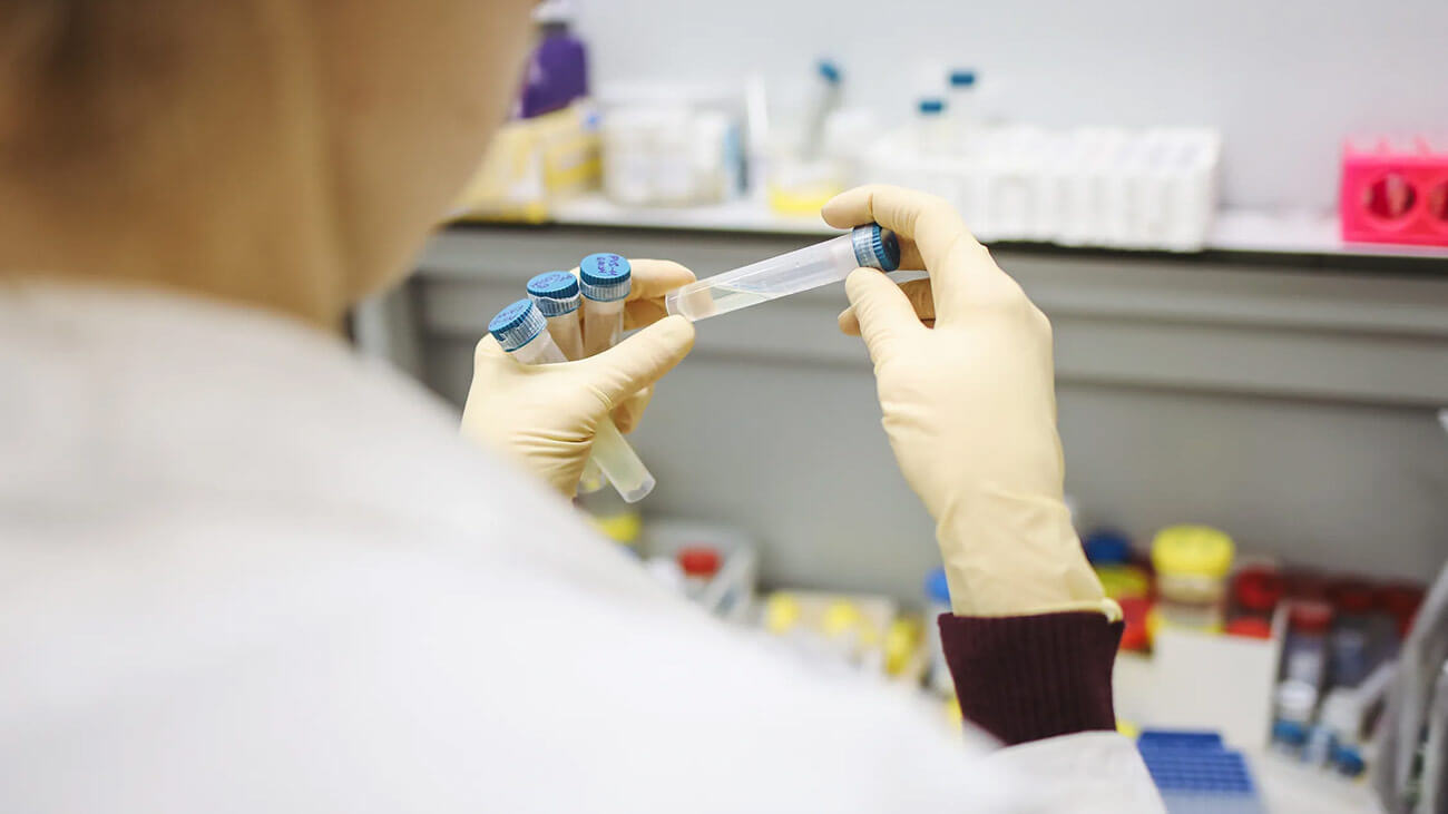 Zľava na test na koronavirus